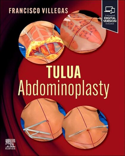 TULUA Abdominoplasty: Transverse Plication Technique