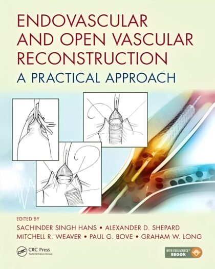 Endovascular and Open Vascular Reconstruction: A Practical Approach