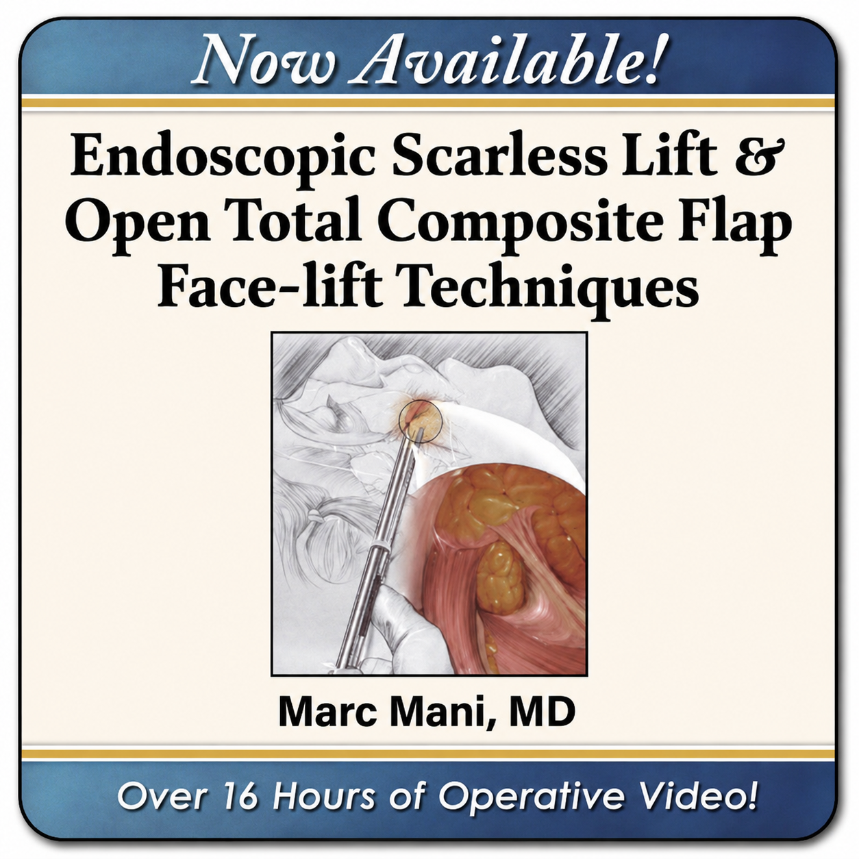 Scarless Endoscopic & Open Composite Plane Face-lifting Techniques 2025